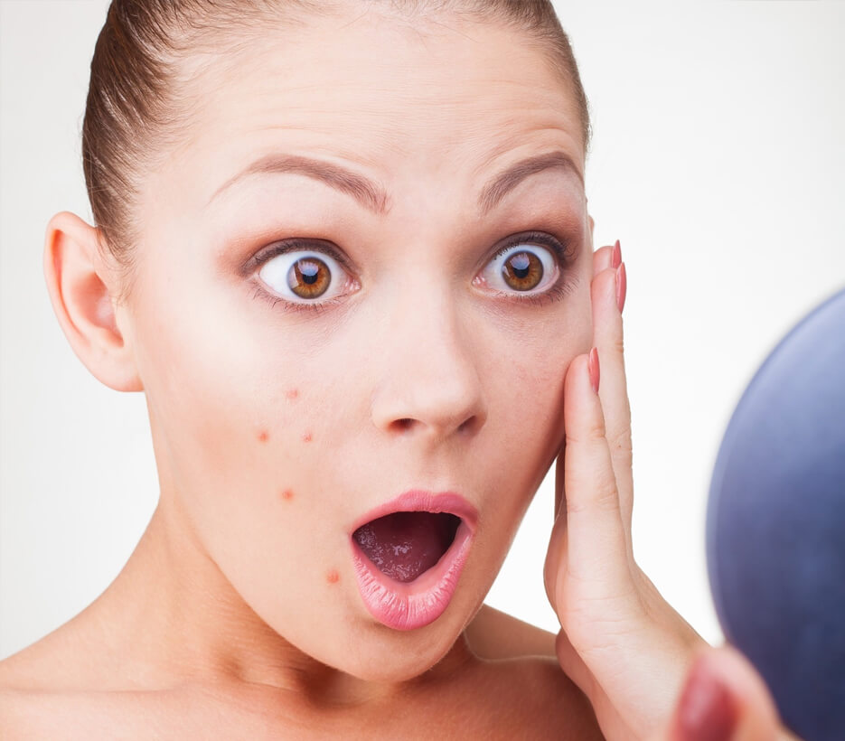 Akne-Skar Tedavileri